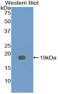 IL12RB2 Antibody - Western blot of recombinant IL12RB2.  This image was taken for the unconjugated form of this product. Other forms have not been tested.