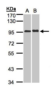 IL12RB2 Antibody - Sample (30 ug whole cell lysate). A: A431, B: Hep G2 . 7.5% SDS PAGE. IL12RB2 antibody diluted at 1:5000