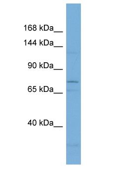 IL12RB2 Antibody - IL12RB2 antibody Western Blot of 721_B. Antibody dilution: 1 ug/ml.  This image was taken for the unconjugated form of this product. Other forms have not been tested.