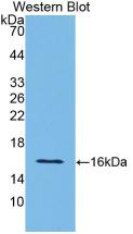 IL12RB2 Antibody - Western Blot; Sample: Recombinant protein.