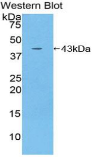IL12RB2 Antibody - Western blot of IL12RB2 antibody.