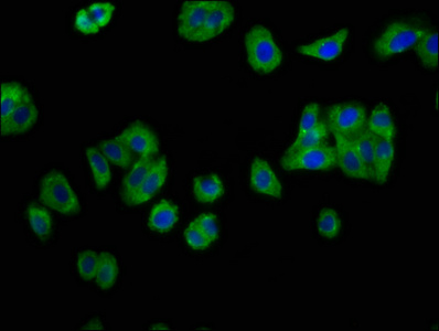 IL12RB2 Antibody - Immunofluorescence staining of HepG2 cells at a dilution of 1:133, counter-stained with DAPI. The cells were fixed in 4% formaldehyde, permeabilized using 0.2% Triton X-100 and blocked in 10% normal Goat Serum. The cells were then incubated with the antibody overnight at 4 °C.The secondary antibody was Alexa Fluor 488-congugated AffiniPure Goat Anti-Rabbit IgG (H+L) .