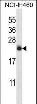 IL13 Antibody - IL13 Antibody western blot of NCI-H460 cell line lysates (35 ug/lane). The IL13 antibody detected the IL13 protein (arrow).