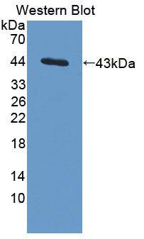 IL13 Antibody - Western blot of IL13 antibody.