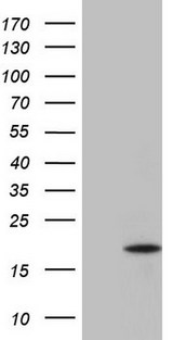 IL13 Antibody - HEK293T cells were transfected with the pCMV6-ENTRY control (Left lane) or pCMV6-ENTRY IL13 (Right lane) cDNA for 48 hrs and lysed. Equivalent amounts of cell lysates (5 ug per lane) were separated by SDS-PAGE and immunoblotted with anti-IL13.