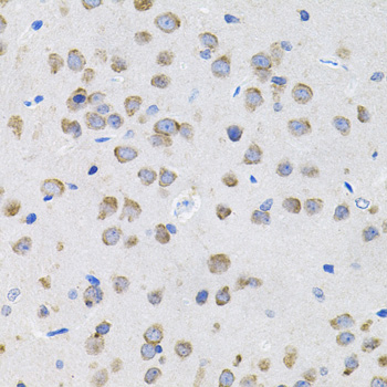 IL13 Antibody - Immunohistochemistry of paraffin-embedded rat brain tissue.