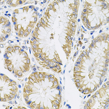IL13 Antibody - Immunohistochemistry of paraffin-embedded human stomach tissue.