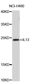 IL13 Antibody - Western blot analysis of extracts of NCI-H460 cells, using IL13 antibody. The secondary antibody used was an HRP Goat Anti-Rabbit IgG (H+L) at 1:10000 dilution. Lysates were loaded 25ug per lane and 3% nonfat dry milk in TBST was used for blocking.