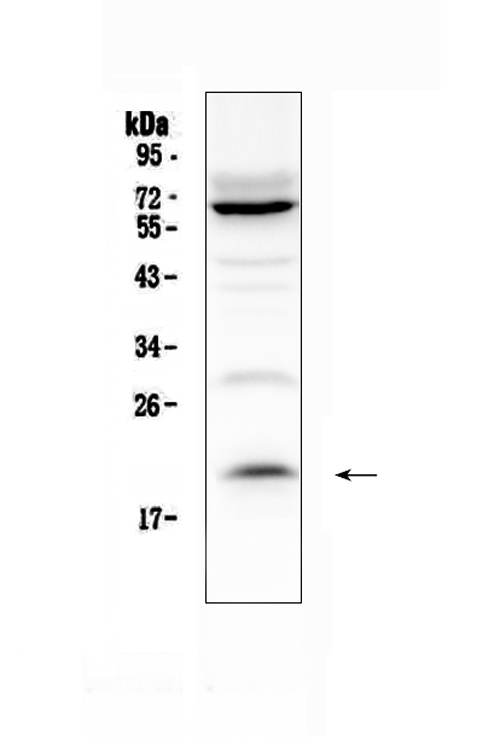 IL13 Antibody - Western blot analysis of IL13 using anti-IL13 antibody. Electrophoresis was performed on a 5-20% SDS-PAGE gel at 70V (Stacking gel) / 90V (Resolving gel) for 2-3 hours. The sample well of each lane was loaded with 50ug of sample under reducing conditions. Lane 1: K562 whole cell lysates. After Electrophoresis, proteins were transferred to a Nitrocellulose membrane at 150mA for 50-90 minutes. Blocked the membrane with 5% Non-fat Milk/ TBS for 1.5 hour at RT. The membrane was incubated with rabbit anti-IL13 antigen affinity purified polyclonal antibody at 0.5 µg/mL overnight at 4°C, then washed with TBS-0.1% Tween 3 times with 5 minutes each and probed with a goat anti-rabbit IgG-HRP secondary antibody at a dilution of 1:10000 for 1.5 hour at RT. The signal is developed using an Enhanced Chemiluminescent detection (ECL) kit with Tanon 5200 system. A specific band was detected for IL13 at approximately 20KD. The expected band size for IL13 is at 16KD.