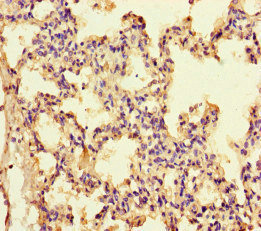 IL13 Antibody - Immunohistochemistry of paraffin-embedded human lung tissue at dilution of 1:100