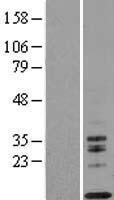 IL13 Protein - Western validation with an anti-DDK antibody * L: Control HEK293 lysate R: Over-expression lysate