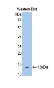 IL13RA1 / IL13R Alpha 1 Antibody - Western blot of recombinant IL13RA1 / IL13R.  This image was taken for the unconjugated form of this product. Other forms have not been tested.