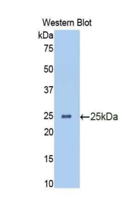 IL13RA1 / IL13R Alpha 1 Antibody - Western blot of recombinant IL13RA1 / IL13R.  This image was taken for the unconjugated form of this product. Other forms have not been tested.