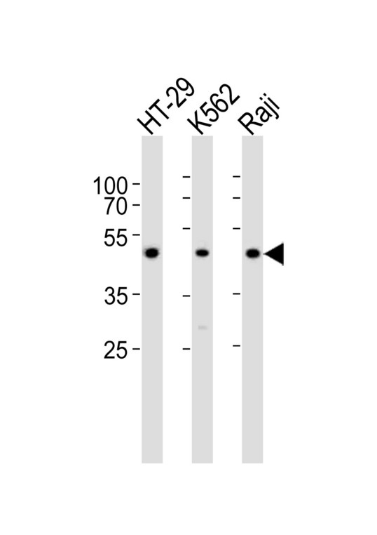 IL13RA1 / IL13R Alpha 1 Antibody - Western blot of lysates from HT-29, K562, Raji cell line (from left to right) with IL13RA1 Antibody. Antibody was diluted at 1:1000 at each lane. A goat anti-rabbit IgG H&L (HRP) at 1:10000 dilution was used as the secondary antibody. Lysates at 35 ug per lane.