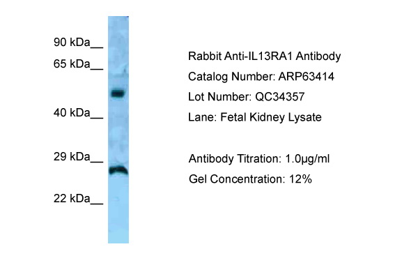 IL13RA1 / IL13R Alpha 1 Antibody -  This image was taken for the unconjugated form of this product. Other forms have not been tested.