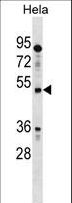 IL13RA1 / IL13R Alpha 1 Antibody - IL13RA1 Antibody western blot of HeLa cell line lysates (35 ug/lane). The IL13RA1 antibody detected the IL13RA1 protein (arrow).
