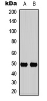 IL13RA1 / IL13R Alpha 1 Antibody - Western blot analysis of CD213a1 (pY405) expression in HCT116 (A); HUVEC (B) whole cell lysates.