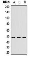 IL13RA1 / IL13R Alpha 1 Antibody - Western blot analysis of CD213a1 expression in MCF7 (A); HUVEC (B); A549 (C) whole cell lysates.