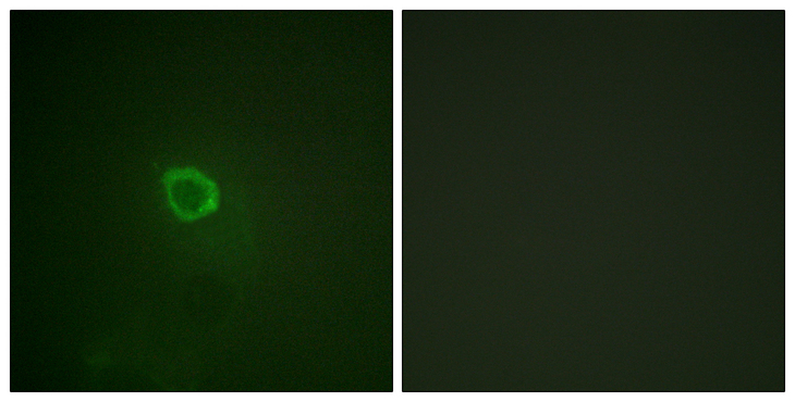 IL13RA1 / IL13R Alpha 1 Antibody - Immunofluorescence analysis of HepG2 cells, using IL-13R alpha1 (Phospho-Tyr405) Antibody. The picture on the right is blocked with the phospho peptide.