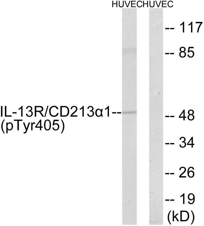 IL13RA1 / IL13R Alpha 1 Antibody - Western blot analysis of extracts from 293 cells, treated with LPS (100ng/ml, 30mins), using IL-13R/CD213a1 (Phospho-Tyr405) antibody.