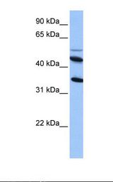 IL13RA2 / IL13R Alpha 2 Antibody - HepG2 cell lysate. Antibody concentration:1.0 ug/ml. Gel concentration: 12%.  This image was taken for the unconjugated form of this product. Other forms have not been tested.