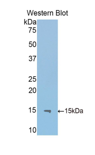 IL13RA2 / IL13R Alpha 2 Antibody - Western blot of recombinant IL13RA2.  This image was taken for the unconjugated form of this product. Other forms have not been tested.