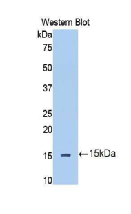 IL13RA2 / IL13R Alpha 2 Antibody - Western blot of recombinant IL13RA2.  This image was taken for the unconjugated form of this product. Other forms have not been tested.