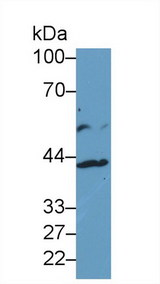 IL13RA2 / IL13R Alpha 2 Antibody - Western Blot; Sample: Human HepG2 cell lysate; Primary Ab: 1µg/ml Rabbit Anti-Human IL13Ra2 Antibody Second Ab: 0.2µg/mL HRP-Linked Caprine Anti-Rabbit IgG Polyclonal Antibody