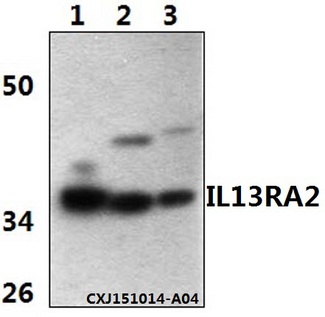 IL13RA2 / IL13R Alpha 2 Antibody - Western blot of IL13RA2 polyclonal antibody at 1:500 dilution. Lane 1: HepG2 whole cell lysate (40 ug). Lane 2: The liver tissue lysate of Mouse(30 ug). Lane 3: The liver tissue lysate of Rat(30 ug).