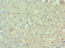 IL13RA2 / IL13R Alpha 2 Antibody - Immunohistochemistry of paraffin-embedded human liver using antibody at 1:100 dilution.