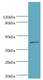 IL13RA2 / IL13R Alpha 2 Antibody - Western blot. All lanes: Interleukin-13 receptor subunit alpha-2 antibody at 5 ug/ml+HeLa whole cell lysate. Secondary antibody: Goat polyclonal to rabbit at 1:10000 dilution. Predicted band size: 44 kDa. Observed band size: 44 kDa Immunohistochemistry.