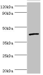IL13RA2 / IL13R Alpha 2 Antibody - Western blot All lanes: Interleukin-13 receptor subunit alpha-2 antibody at 5µg/ml + Hela whole cell lysate Secondary Goat polyclonal to rabbit IgG at 1/10000 dilution Predicted band size: 44 kDa Observed band size: 44 kDa