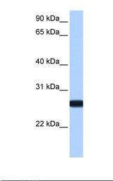 IL13RA2 / IL13R Alpha 2 Antibody - MCF7 cell lysate. Antibody concentration: 1.0 ug/ml. Gel concentration: 12%.  This image was taken for the unconjugated form of this product. Other forms have not been tested.