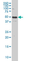 IL13RA2 / IL13R Alpha 2 Antibody - IL13RA2 monoclonal antibody (M01), clone 2E10. Western Blot analysis of IL13RA2 expression in HeLa.
