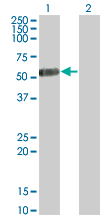 IL13RA2 / IL13R Alpha 2 Antibody - Western Blot analysis of IL13RA2 expression in transfected 293T cell line by IL13RA2 monoclonal antibody (M01), clone 2E10.Lane 1: IL13RA2 transfected lysate(44.176 KDa).Lane 2: Non-transfected lysate.