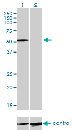 IL13RA2 / IL13R Alpha 2 Antibody - Western blot analysis of IL13RA2 over-expressed 293 cell line, cotransfected with IL13RA2 Validated Chimera RNAi (Lane 2) or non-transfected control (Lane 1). Blot probed with IL13RA2 monoclonal antibody (M01), clone 2E10 . GAPDH ( 36.1 kDa ) used as specificity and loading control.