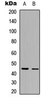 IL13RA2 / IL13R Alpha 2 Antibody - Western blot analysis of CD213a2 expression in HepG2 (A); HeLa (B) whole cell lysates.