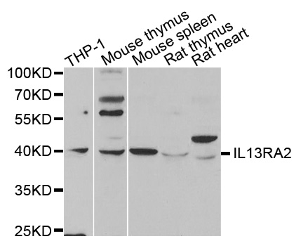 IL13RA2 / IL13R Alpha 2 Antibody - Western blot analysis of extracts of various cell lines.