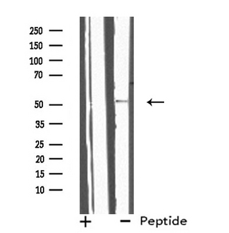 IL13RA2 / IL13R Alpha 2 Antibody - Western blot analysis of extracts of HepG2 cells using IL13RA2 antibody.