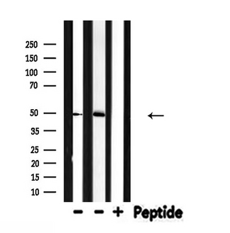 IL13RA2 / IL13R Alpha 2 Antibody - Western blot analysis of IL13RA2 expression in various lysates