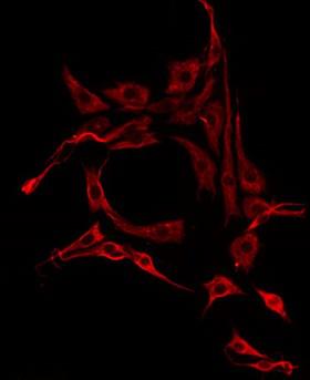 IL13RA2 / IL13R Alpha 2 Antibody - Staining HepG2 cells by IF/ICC. The samples were fixed with PFA and permeabilized in 0.1% Triton X-100, then blocked in 10% serum for 45 min at 25°C. The primary antibody was diluted at 1:200 and incubated with the sample for 1 hour at 37°C. An Alexa Fluor 594 conjugated goat anti-rabbit IgG (H+L) Ab, diluted at 1/600, was used as the secondary antibody.