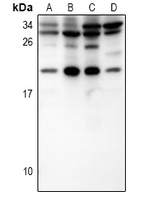 IL15 Antibody - Western blot analysis of IL-15 expression in HepG2 (A), HEK293T (B), AML12 (C), H9C2 (D) whole cell lysates.