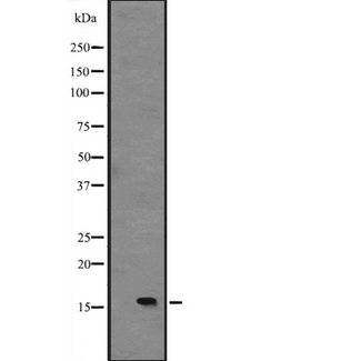 IL15 Antibody - Western blot analysis of IL15 expression in Foetal liver tissue lysate. The lane on the left is treated with the antigen-specific peptide.