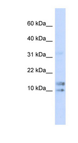 IL15 Antibody - IL15 / IL-15 antibody Western blot of 293T cell lysate. This image was taken for the unconjugated form of this product. Other forms have not been tested.