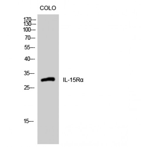 IL15RA Antibody - Western blot of IL-15Ralpha antibody