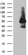 IL15RA Antibody - HEK293T cells were transfected with the pCMV6-ENTRY control. (Left lane) or pCMV6-ENTRY IL15RA. (Right lane) cDNA for 48 hrs and lysed. Equivalent amounts of cell lysates. (5 ug per lane) were separated by SDS-PAGE and immunoblotted with anti-IL15RA. (1:500)