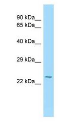 IL15RA Antibody - IL15RA antibody Western Blot of Mouse Liver.  This image was taken for the unconjugated form of this product. Other forms have not been tested.