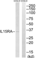 IL15RA Antibody - Western blot analysis of lysates from COLO cells, using IL15RA Antibody. The lane on the right is blocked with the synthesized peptide.