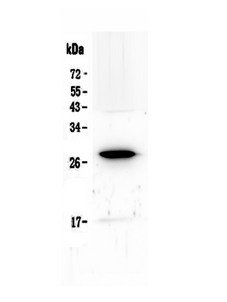 IL15RA Antibody - Western blot - Anti-IL15RA Picoband Antibody