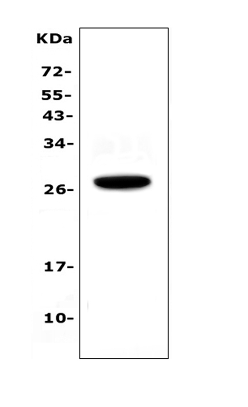 IL15RA Antibody - Western blot analysis of IL15RA using anti-IL15RA antibody. Electrophoresis was performed on a 5-20% SDS-PAGE gel at 70V (Stacking gel) / 90V (Resolving gel) for 2-3 hours. The sample well of each lane was loaded with 50ug of sample under reducing conditions. Lane 1: human placenta tissue lysates. After Electrophoresis, proteins were transferred to a Nitrocellulose membrane at 150mA for 50-90 minutes. Blocked the membrane with 5% Non-fat Milk/ TBS for 1.5 hour at RT. The membrane was incubated with rabbit anti-IL15RA antigen affinity purified polyclonal antibody at 0.5 ug/mL overnight at 4?, then washed with TBS-0.1% Tween 3 times with 5 minutes each and probed with a goat anti-rabbit IgG-HRP secondary antibody at a dilution of 1:10000 for 1.5 hour at RT. The signal is developed using an Enhanced Chemiluminescent detection (ECL) kit with Tanon 5200 system. A specific band was detected for IL15RA at approximately 28KD. The expected band size for IL15RA is at 28KD.